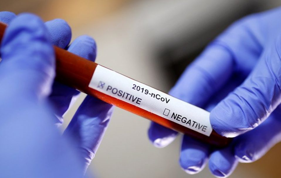 136 нових випадків коронавірусу на Волині: де виявили хворих