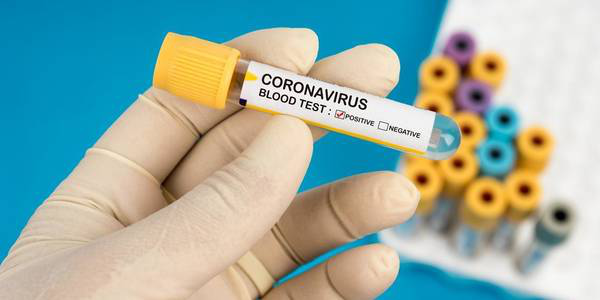 Можна виявити коронавірус до появи симптомів: у Луцьк доставили нові тести