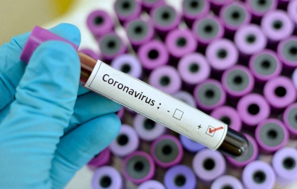 В Україні вже 2777 випадків коронавірусу: на Волині – 71