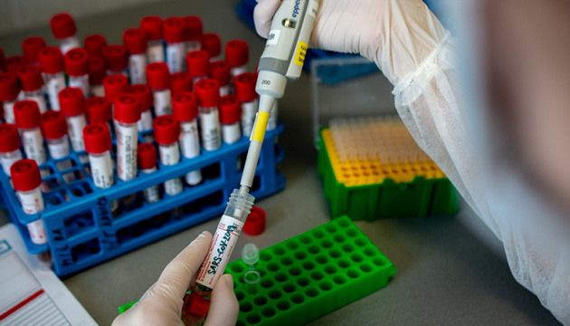 Із 4 до 69: в Україні стало більше лабораторій з тестуванням на коронавірус