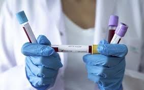 Новий спалах коронавірусу на Ратнівщині: хто захворів