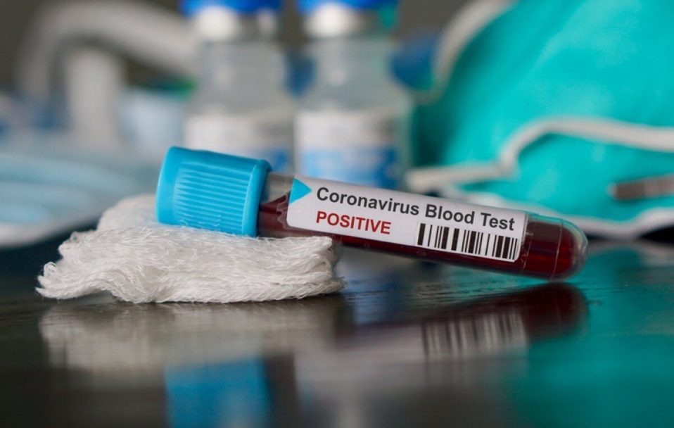 В Україні – 2 134 нових випадків коронавірусу, на Волині – 51