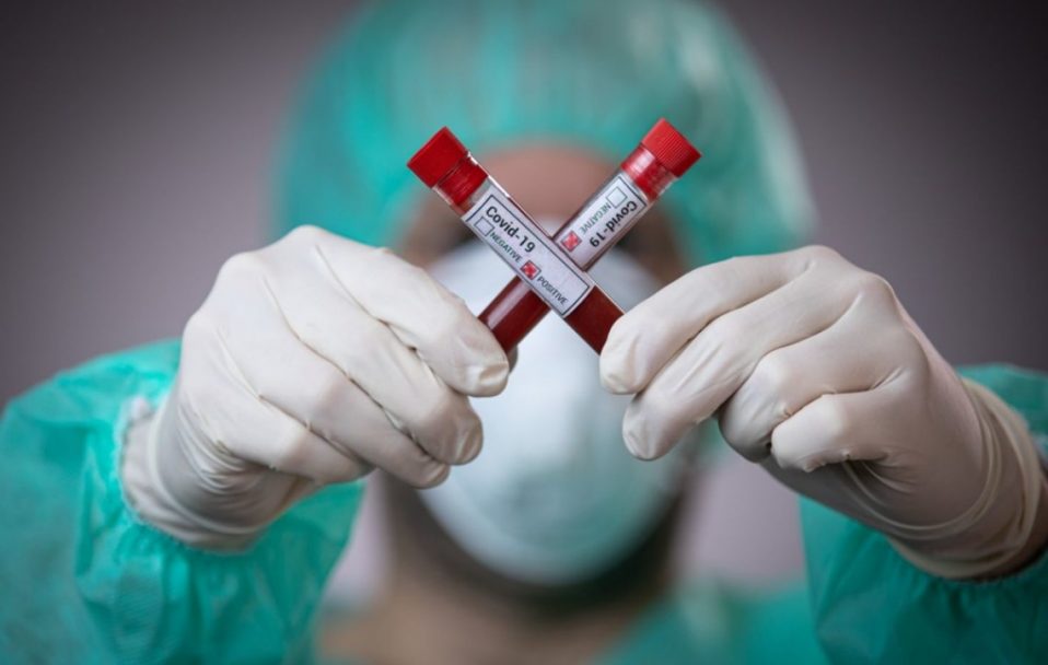 В Україні –  5 469 нових випадків коронавірусу за добу, на Волині – 178