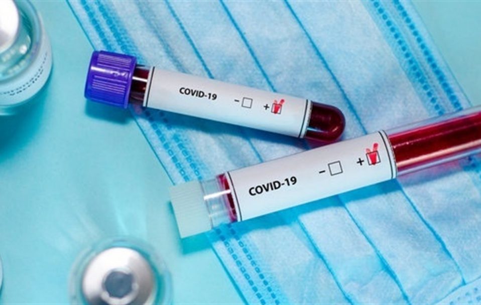 В Україні – 10 622 нових випадки коронавірусу за добу, на Волині – 396 людей