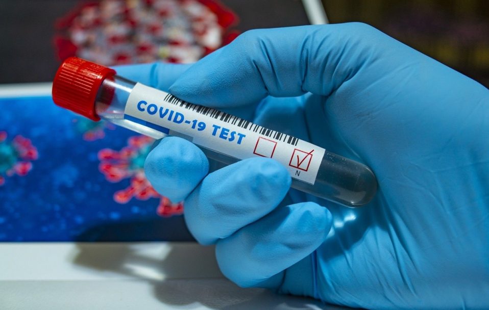 509 хворих за добу: де на Волині виявили нові випадки коронавірусу