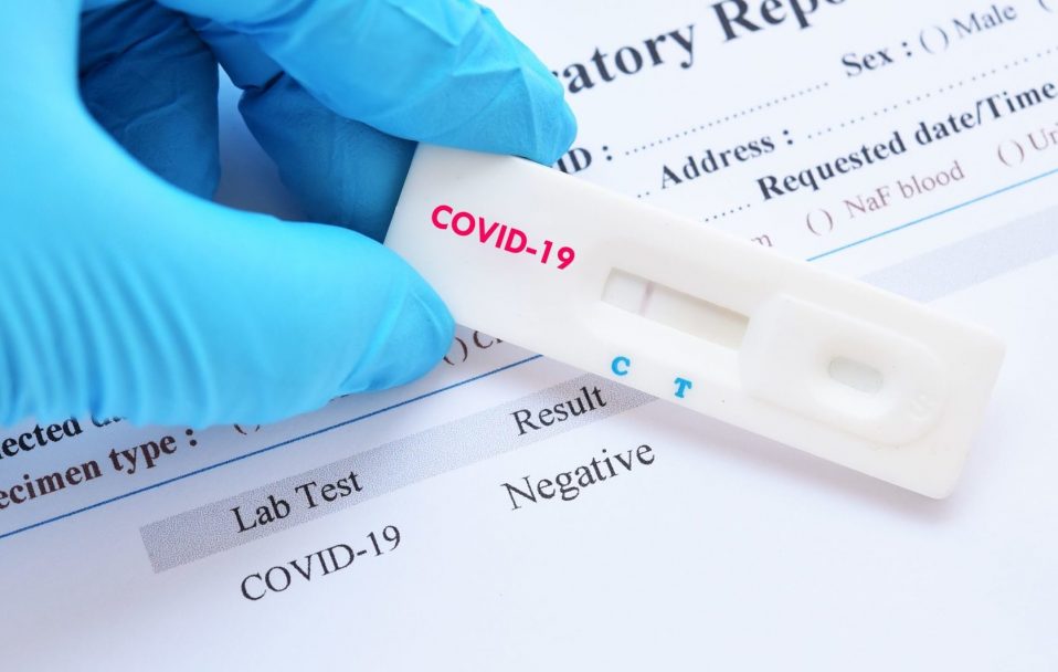 В Україні – 4 069 нових випадків коронавірусу, на Волині – 135