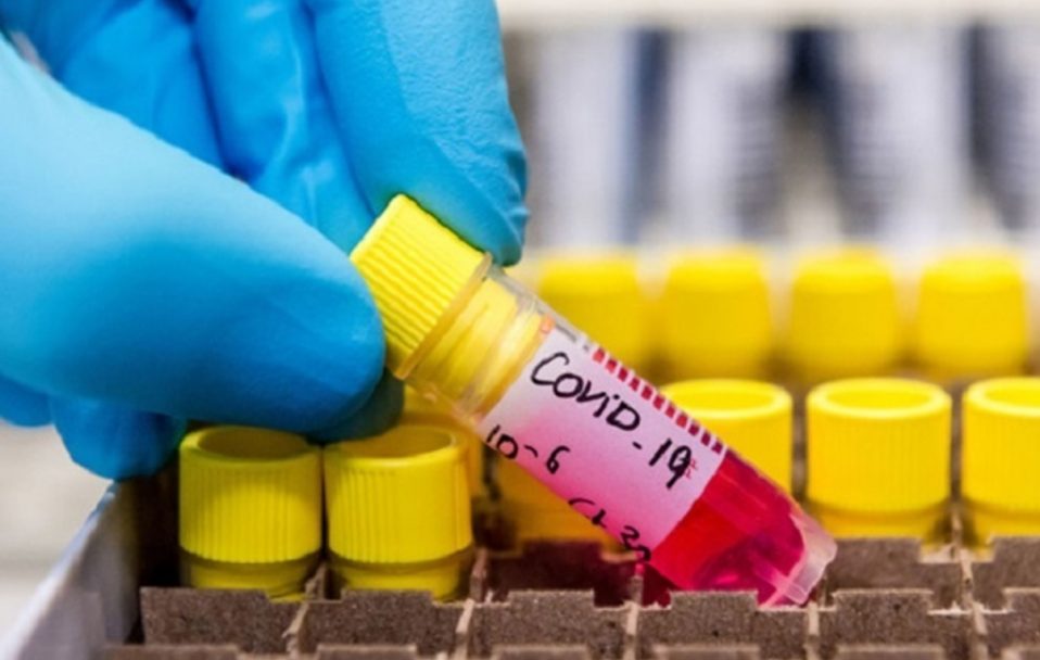 331 новий випадок коронавірусу на Волині: де виявили хворих