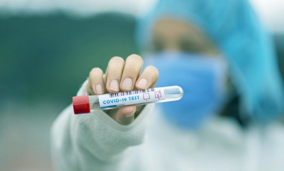 За добу коронавірус виявили у понад 400 українців