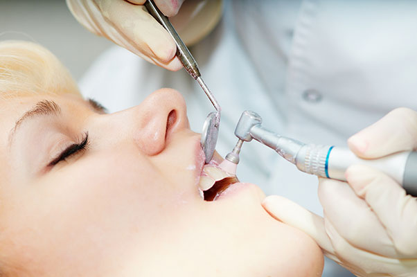 Знижка 15% на професійну гігієну ротової порожнини та зубів: куди звертатися