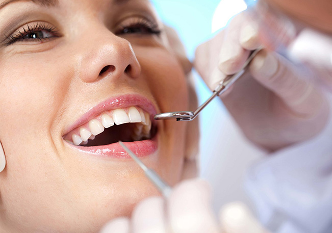 П’ять причин видалити зубний камінь