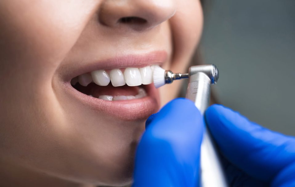 Професійне чищення зубів – запорука здорової усмішки