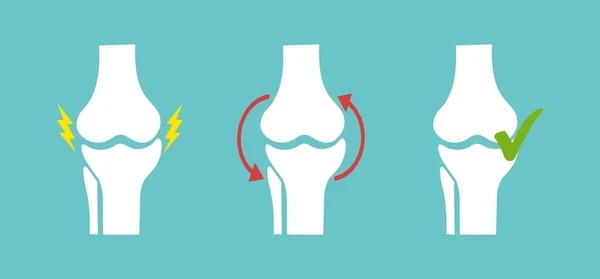 Спостереження за змінами у стані суглобів під час прийому хондропротекторів